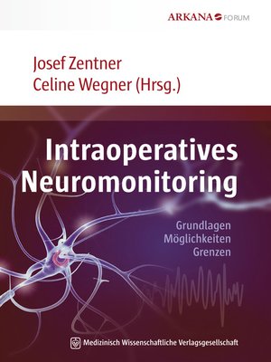 cover image of Intraoperatives Neuromonitoring
